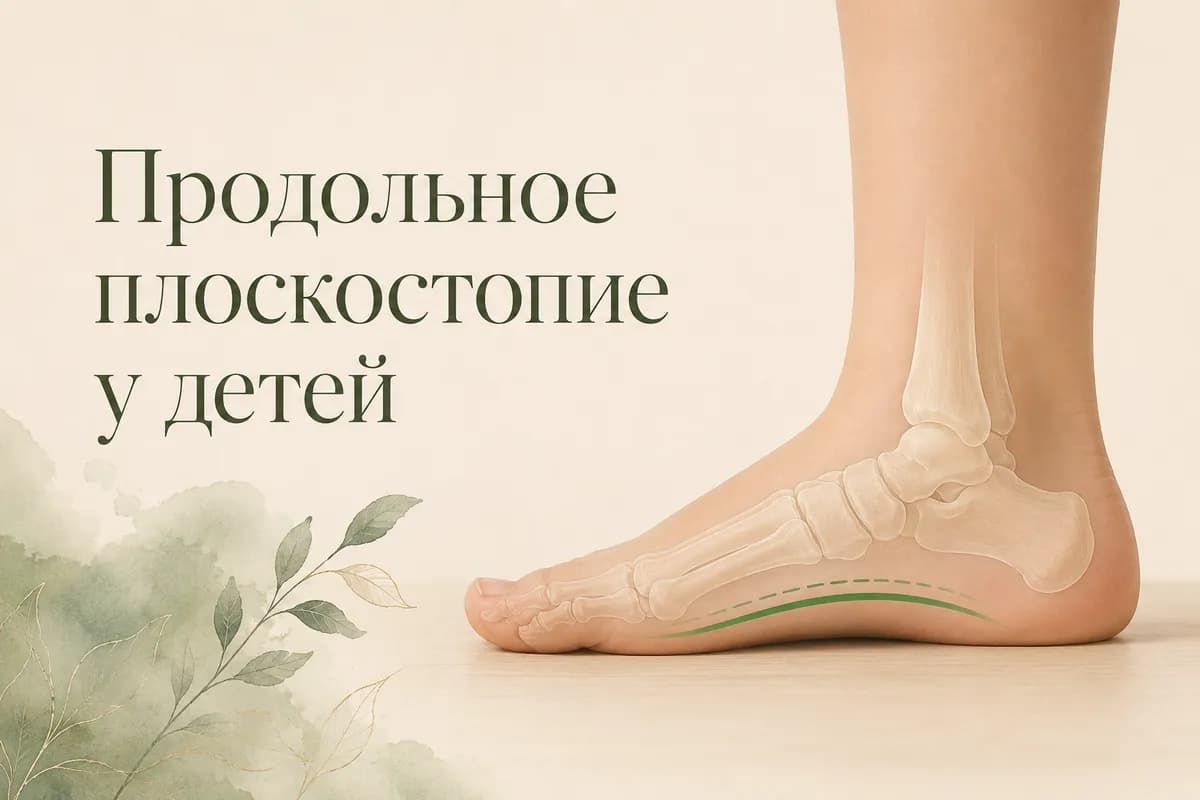 Обложка статьи «Продольное плоскостопие у детей»